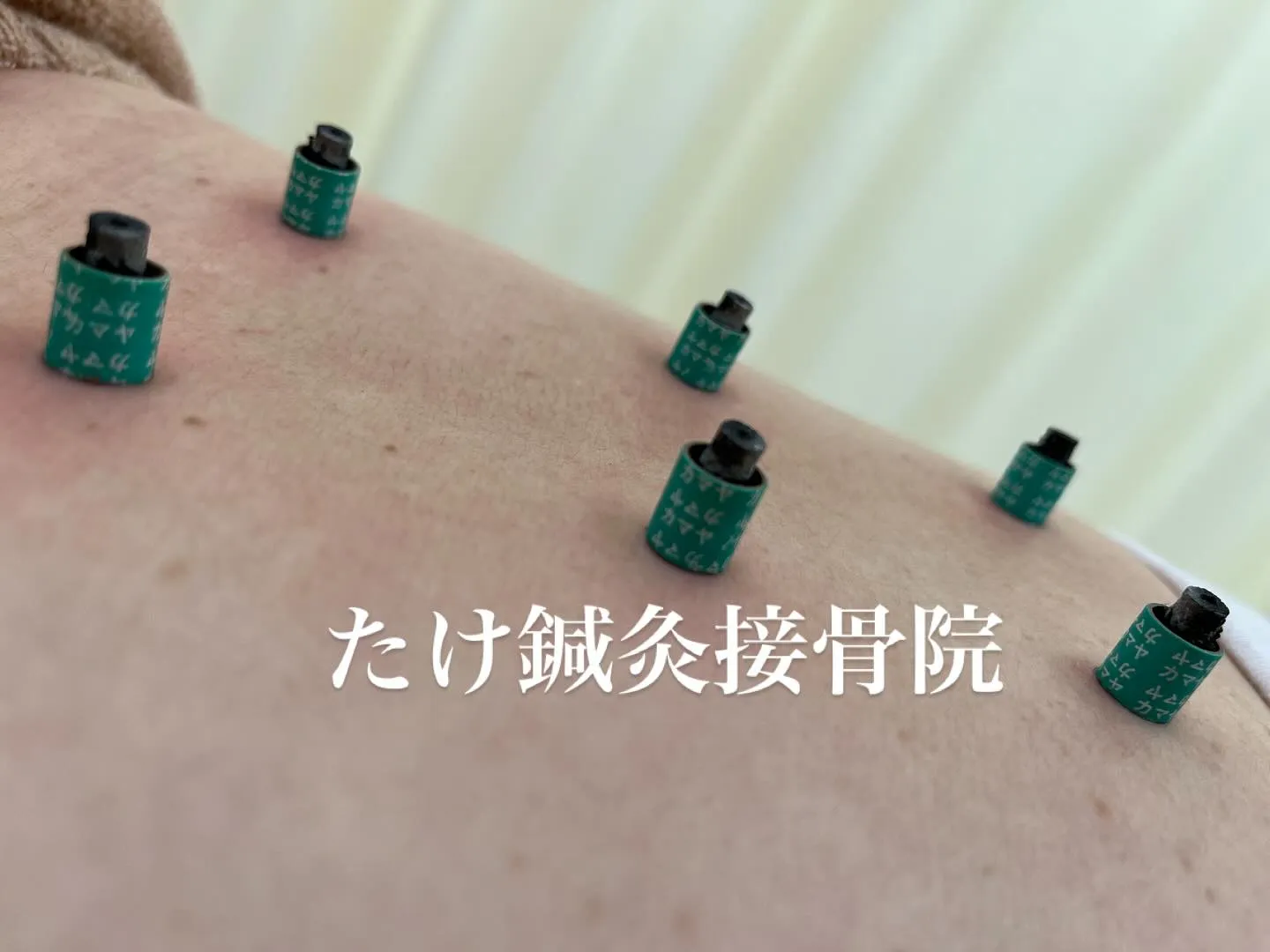 お灸は、温熱刺激による血行促進、免疫機能の向上、そしてツボ刺...